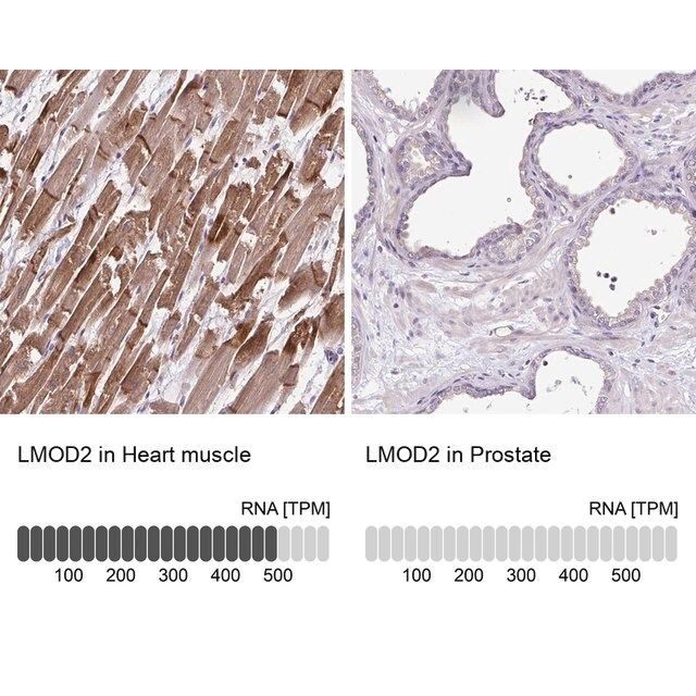 Anti-LMOD2 antibody produced in rabbit