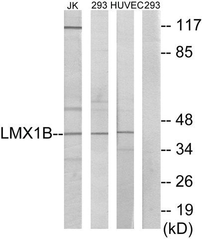 Anti-LMX1B antibody produced in rabbit