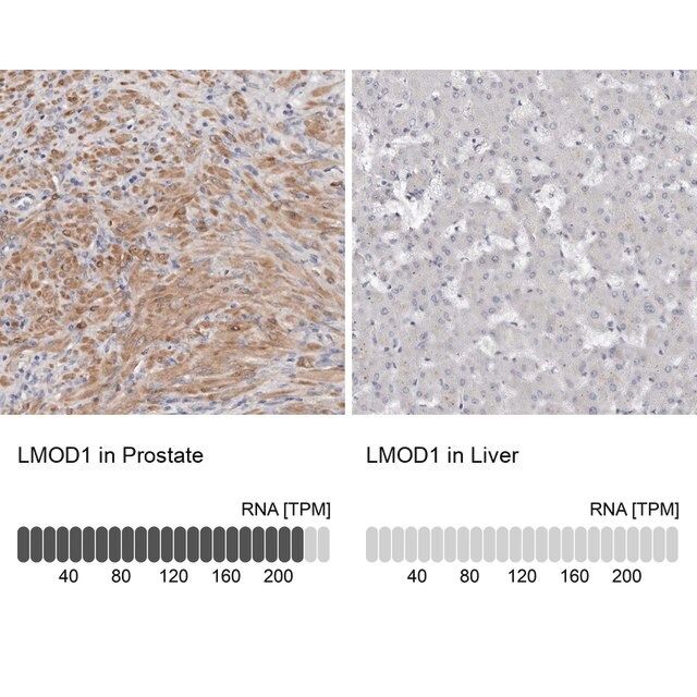 Anti-LMOD1 antibody produced in rabbit