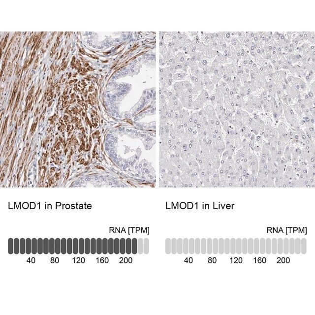 Anti-LMOD1 antibody produced in rabbit