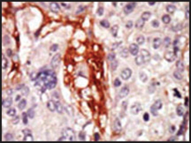 Anti-LOK (N-term) antibody produced in rabbit