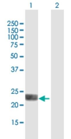 ANTI-LOH12CR1 antibody produced in mouse