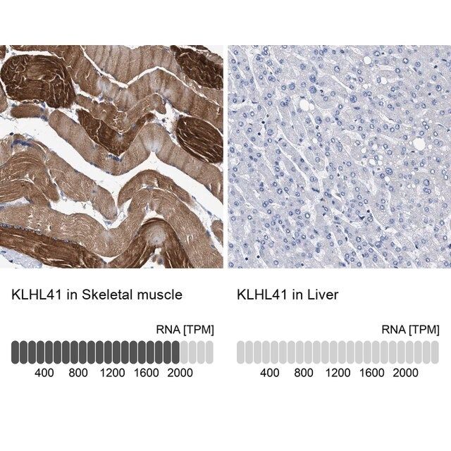 Anti-KLHL41 antibody produced in rabbit