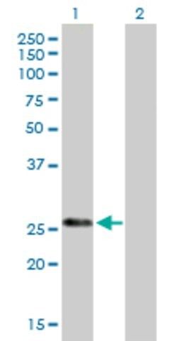 Anti-KLK7 antibody produced in mouse