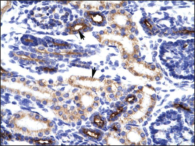 Anti-KLHL14 antibody produced in rabbit