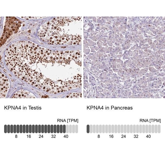 Anti-KPNA4 antibody produced in rabbit