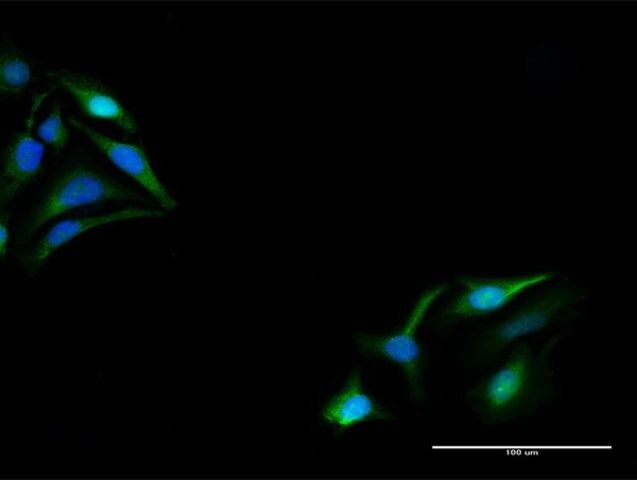 Anti-KPNA5 antibody produced in rabbit