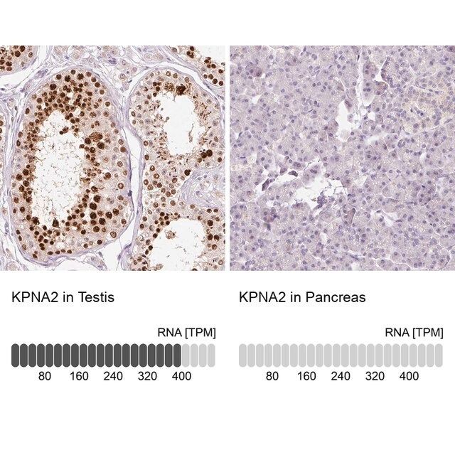 Anti-KPNA2 antibody produced in rabbit