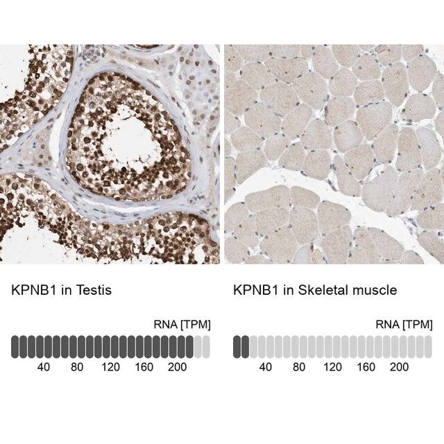 Anti-KPNB1 antibody produced in rabbit