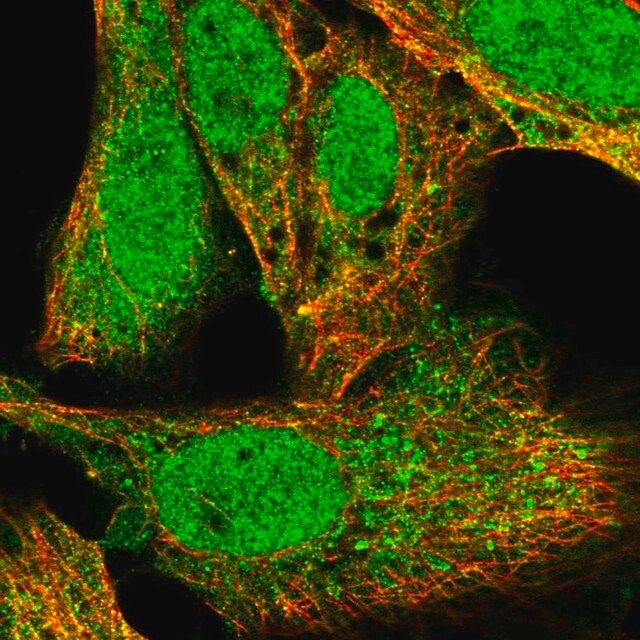 Anti-KPNA1 antibody produced in rabbit