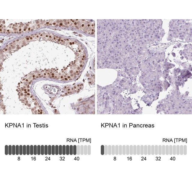 Anti-KPNA1 antibody produced in rabbit