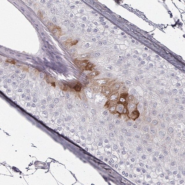 Anti-KRT84 antibody produced in rabbit