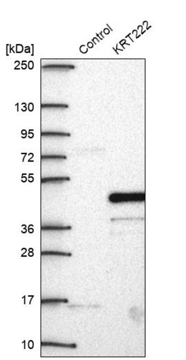 Anti-KRT222 antibody produced in rabbit