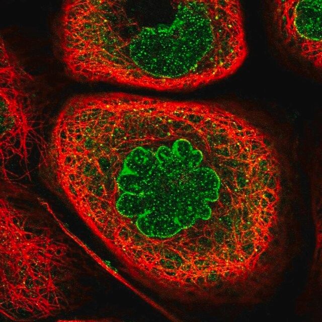 Anti-KPNB1 antibody produced in rabbit