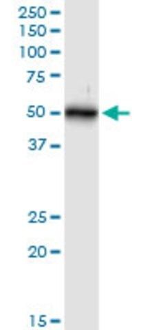 Anti-KRT16 antibody produced in rabbit