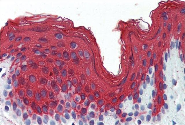 Anti-KRT1 antibody produced in rabbit