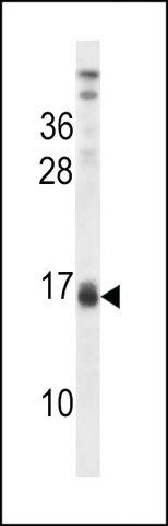 ANTI-LALBA (CENTER) antibody produced in rabbit