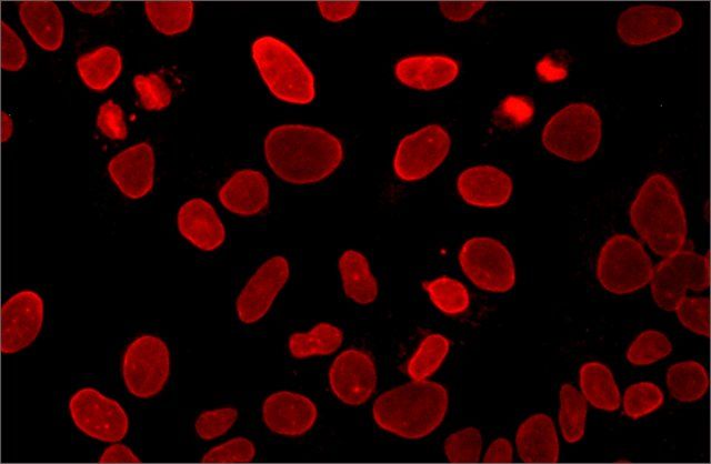 Anti-Lamin A, mature antibody, Mouse monoclonal