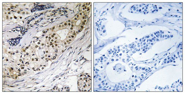 Anti-LAMA3 antibody produced in rabbit