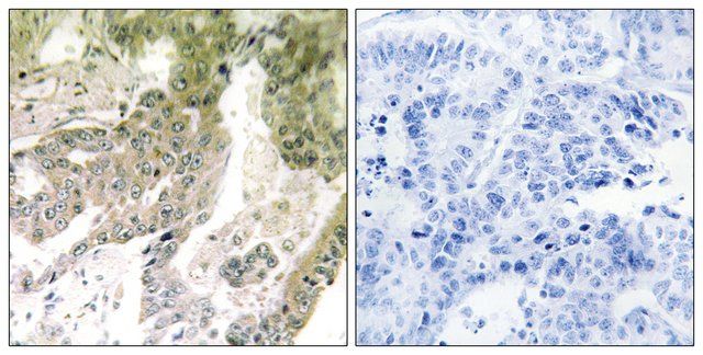 Anti-LAMA5 antibody produced in rabbit