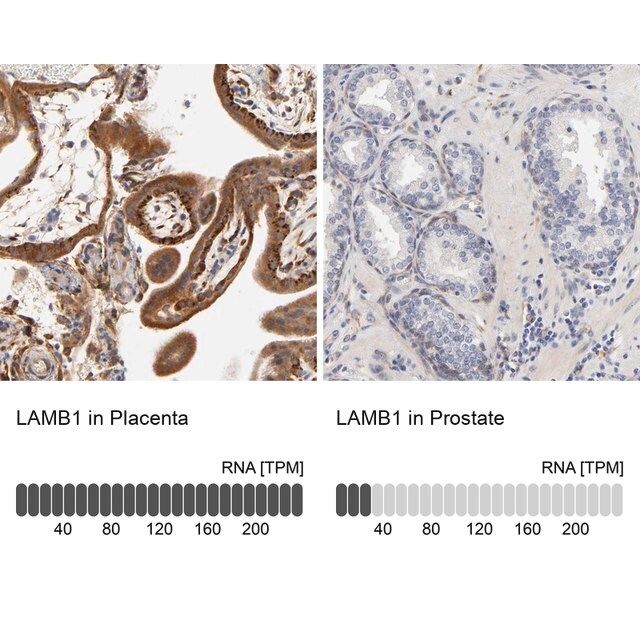 Anti-LAMB1 antibody produced in rabbit