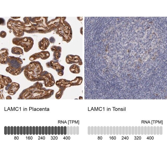 Anti-LAMC1 antibody produced in rabbit