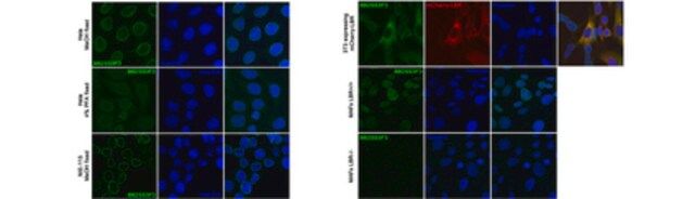 Anti-Lamin B Receptor (LBR) Antibody, clone BB2SS3F3