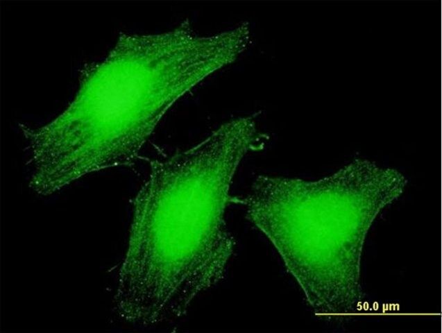 Anti-LARP6 antibody produced in mouse