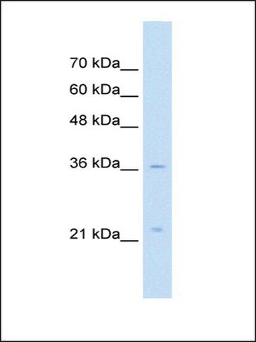 Anti-LAPTM4A antibody produced in rabbit