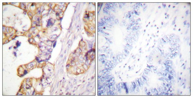 Anti-Keratin 8 antibody produced in rabbit