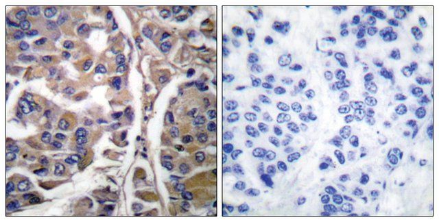 Anti-Keratin 20 antibody produced in rabbit