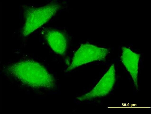 Anti-KIAA1404 antibody produced in mouse