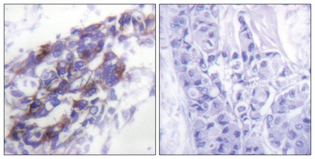 Anti-Keratin 8 antibody produced in rabbit