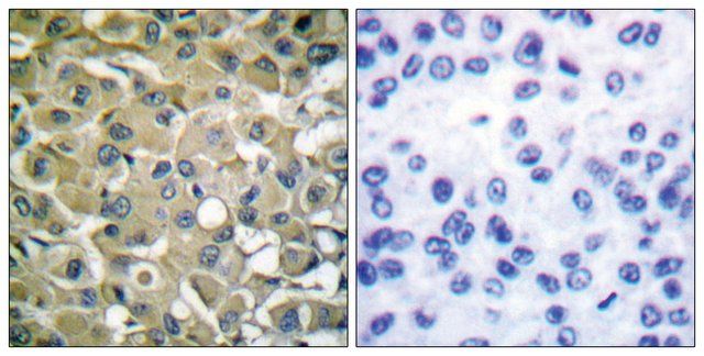 Anti-Keratin 18 antibody produced in rabbit