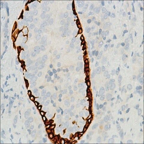 Anti-Keratin 6 antibody, Rabbit monoclonal