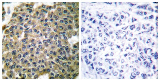 Anti-Keratin 7 antibody produced in rabbit