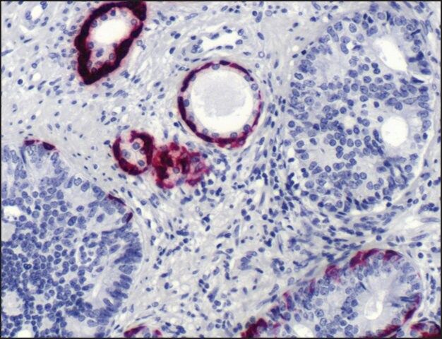 Anti-Keratin 5 antibody, Rabbit monoclonal