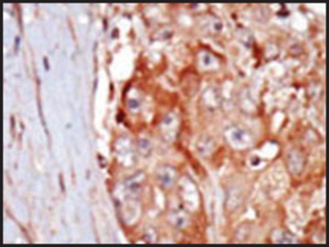 Anti-KHS2 (C-term) antibody produced in rabbit