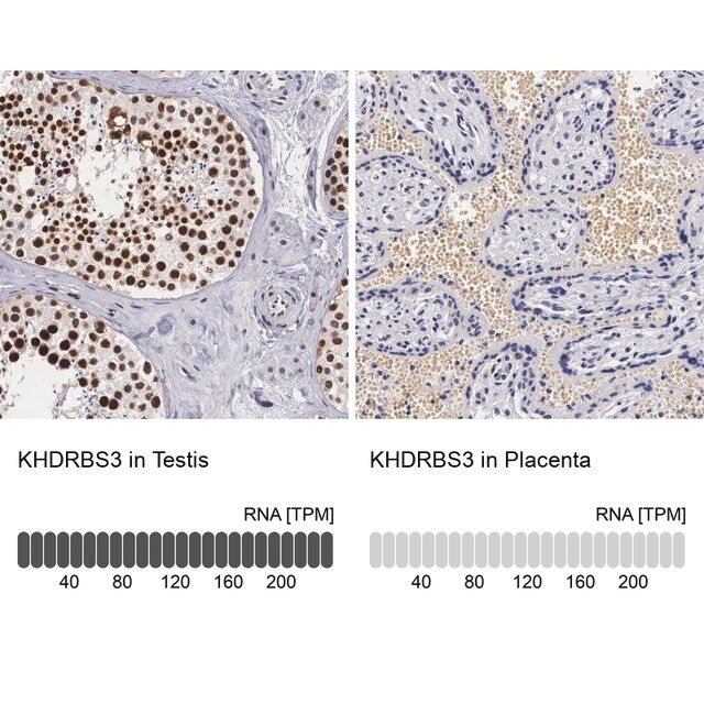 Anti-KHDRBS3 antibody produced in rabbit