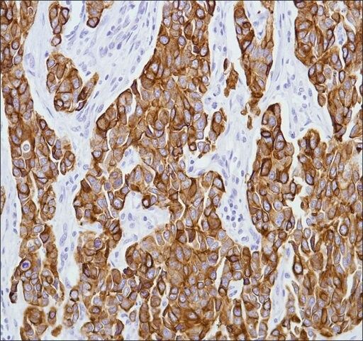 Anti-Keratin 8 antibody, Rabbit monoclonal