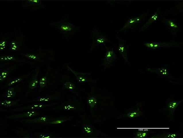 Anti-KIAA0020 antibody produced in mouse