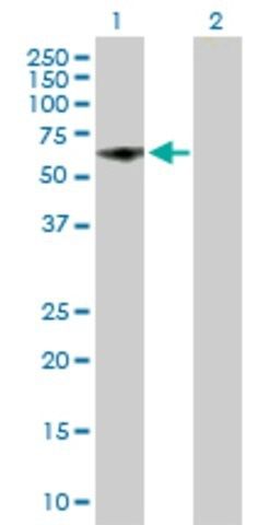 Anti-KIAA0409 antibody produced in mouse