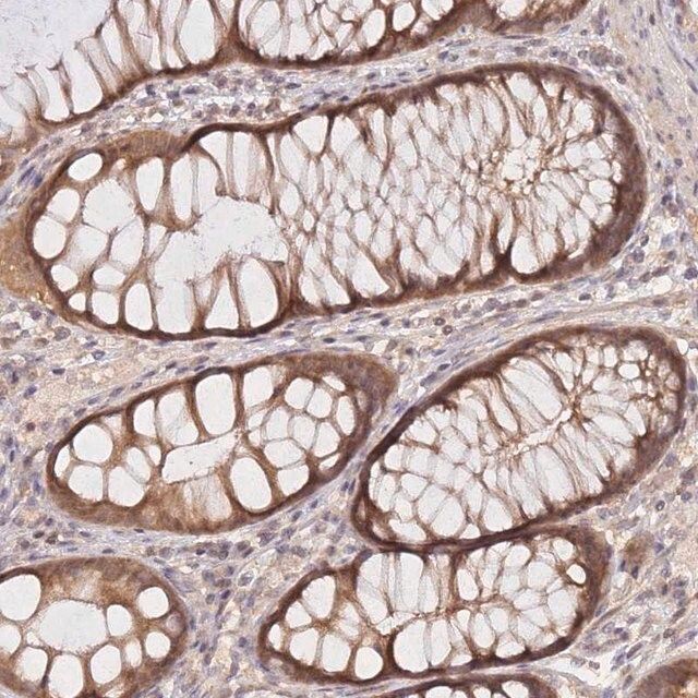 Anti-KIAA1191 antibody produced in rabbit