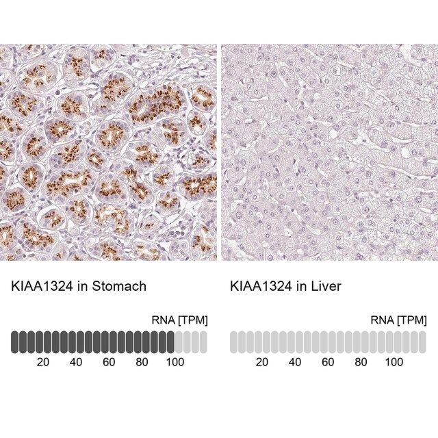 Anti-KIAA1324 antibody produced in rabbit