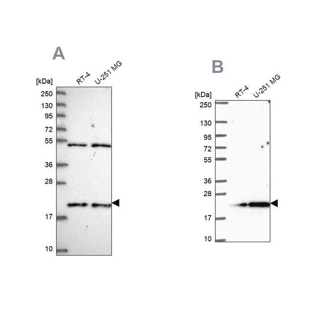 Anti-KIAA1143 antibody produced in rabbit