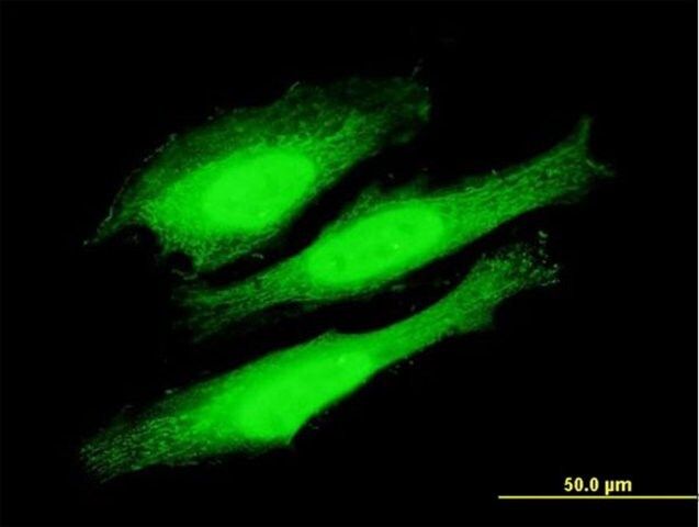 Anti-KIAA1967 antibody produced in mouse