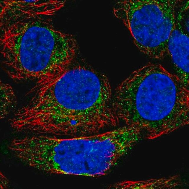 Anti-KHDC1 antibody produced in rabbit