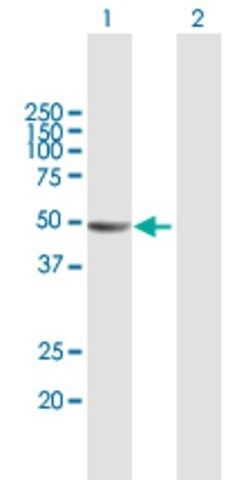 Anti-KIAA1576 antibody produced in mouse