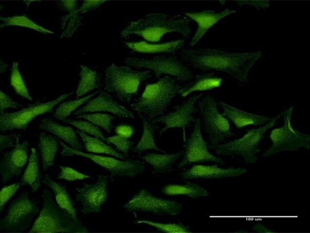 Anti-KIAA0101 antibody produced in mouse