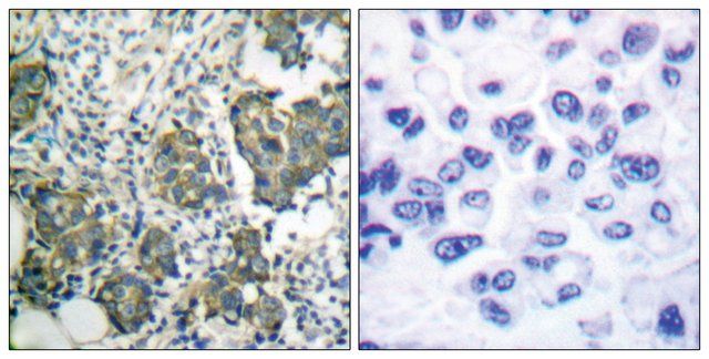 Anti-Keratin 8 antibody produced in rabbit